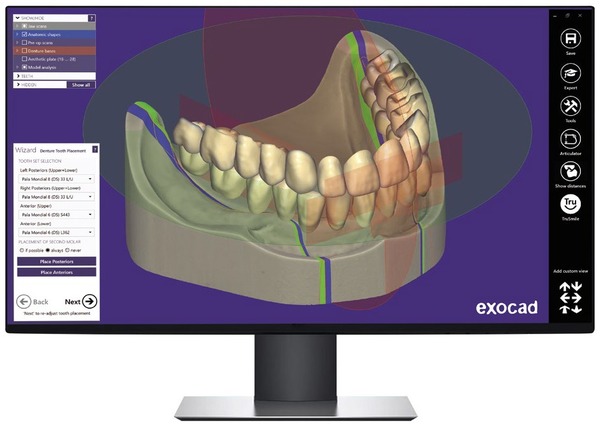 DentalCAD software by Exocad