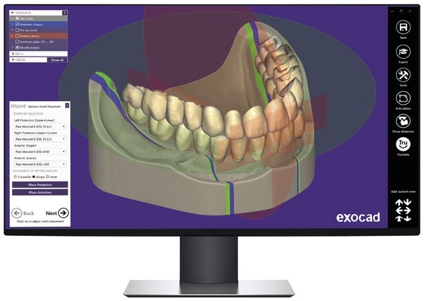 Programma DentalCAD di Exocad